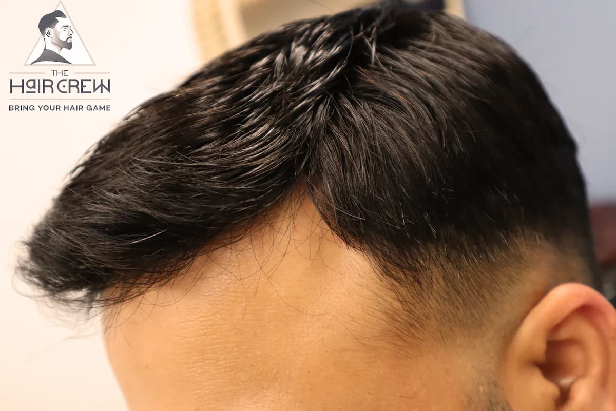 Side view of a client freshly fitted hair system