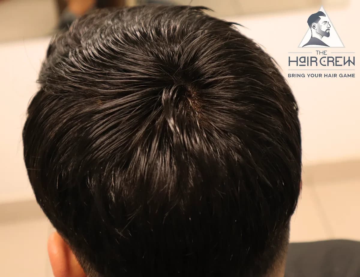Top and back view of a client styled hair system