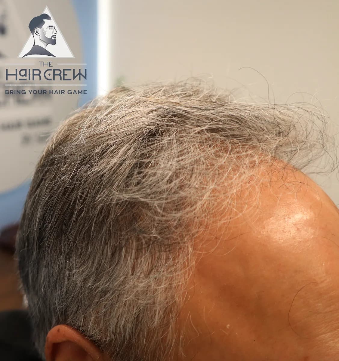 Hair Crew client showing his finished, natural-looking hair system