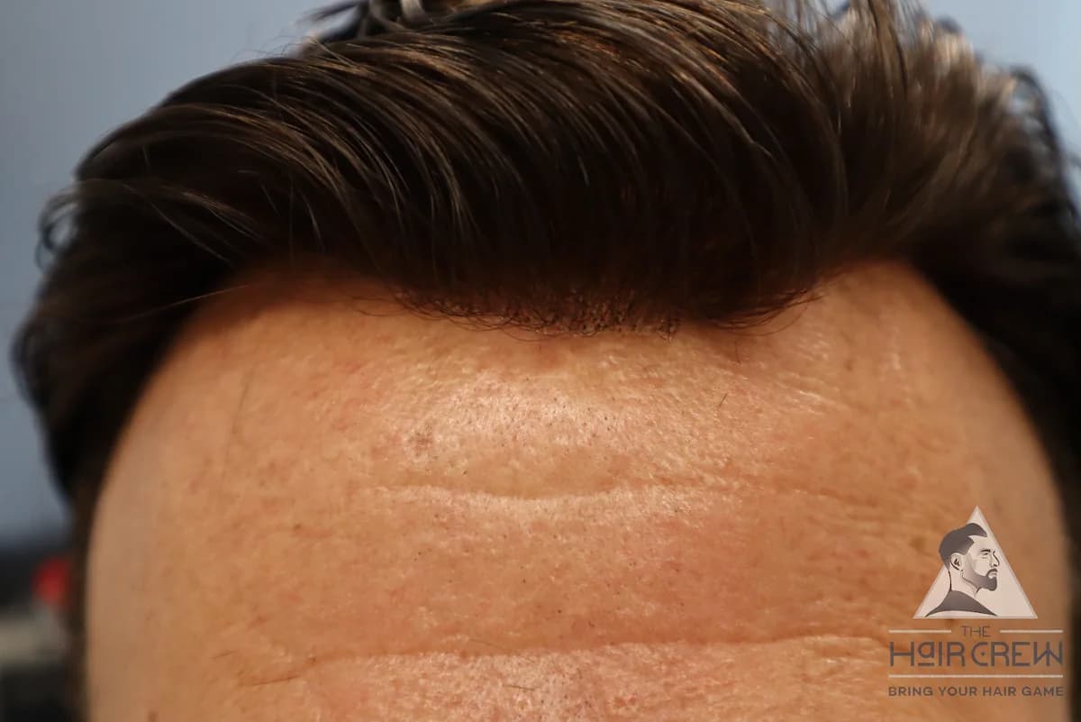 Close-up of a natural-looking hairline on a Hair Crew client