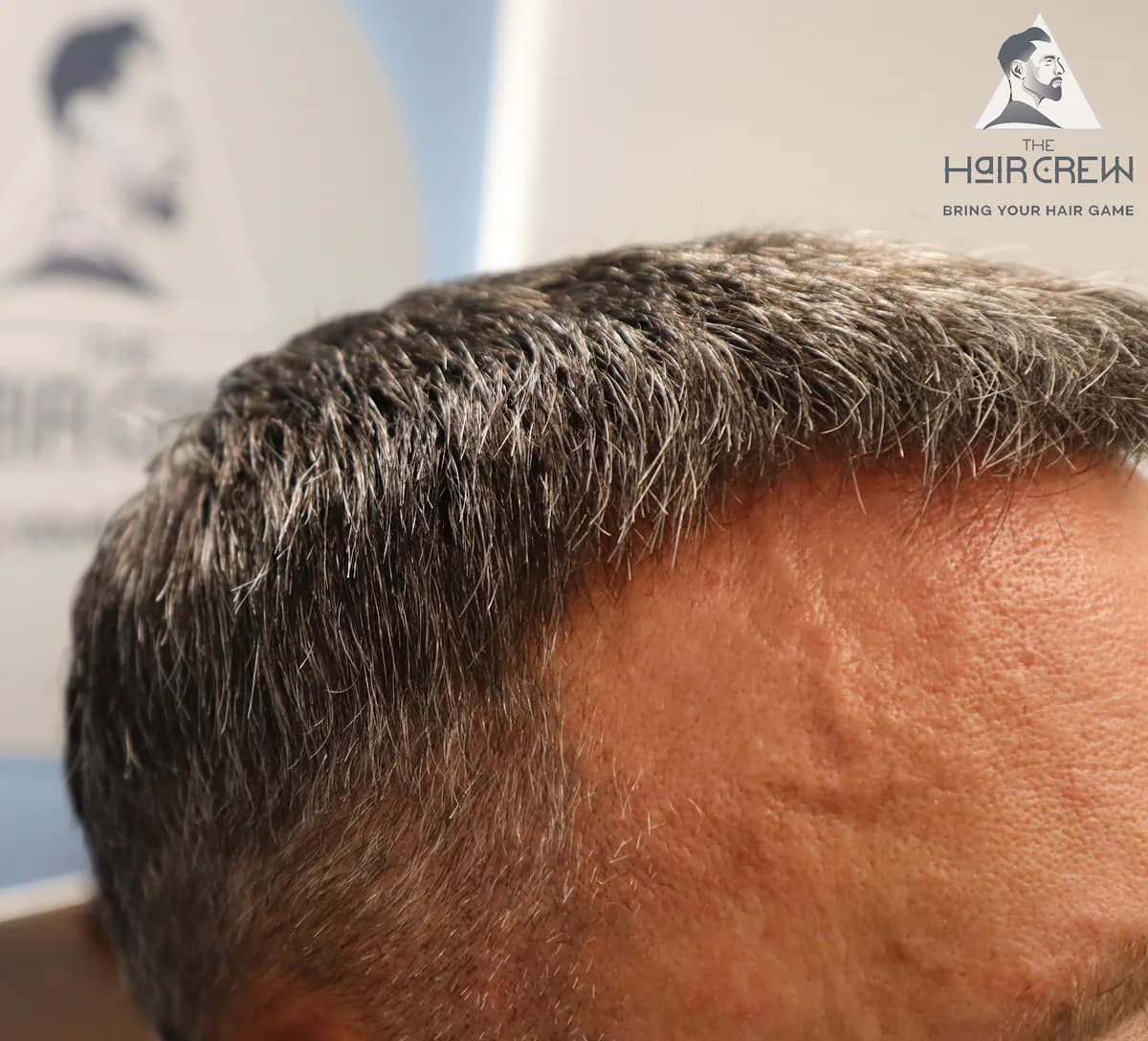 Hair Crew client showing his finished, natural-looking hair system