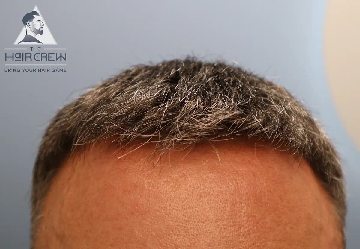 Front view of a client's short salt-and-pepper hair system